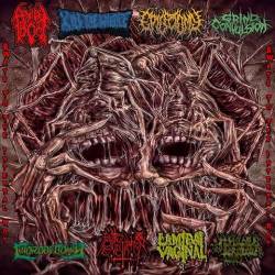 Epilectomy : 8 Ways to the Internal Rot